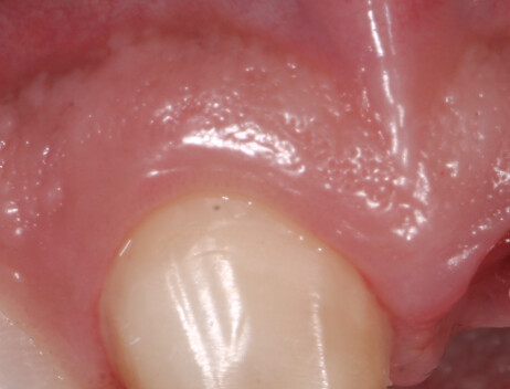 Stability — clinical detail