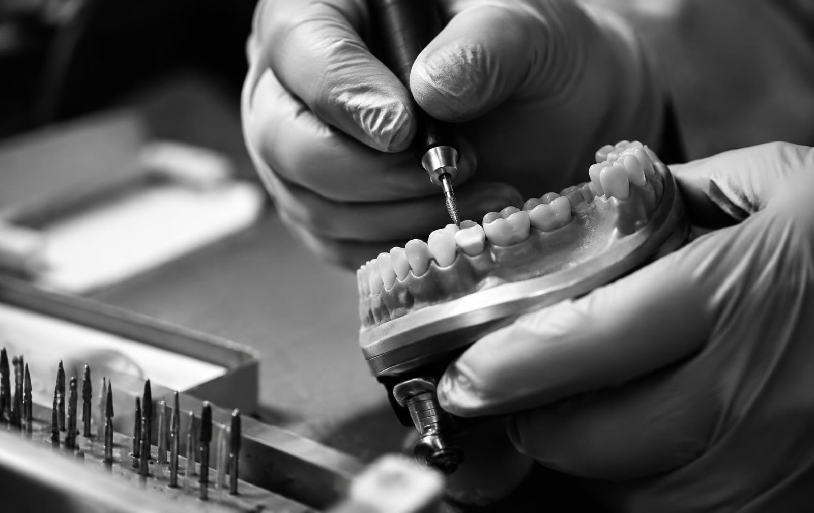 Clinician preparing a tooth on a training model with a fine diamond bur